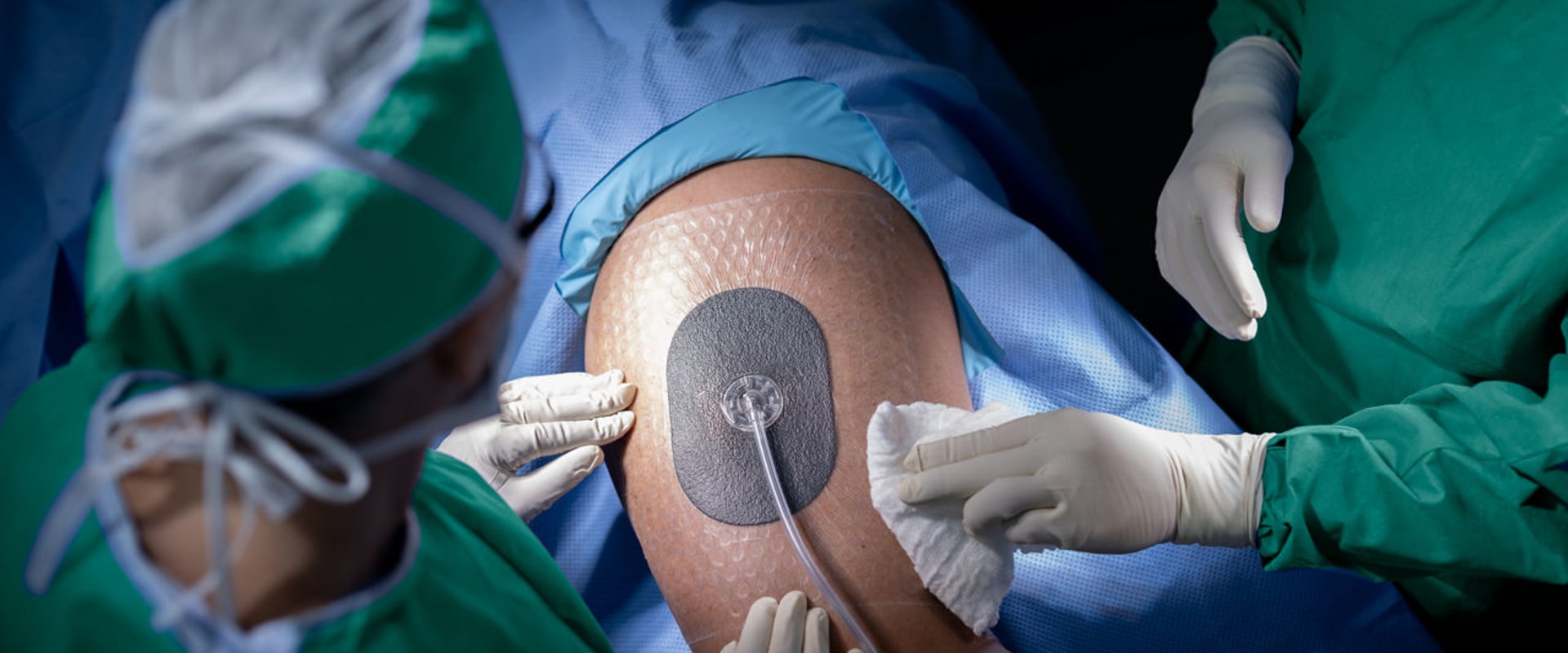 The Revolutionary Impact of Negative Pressure Therapy on Wound Healing