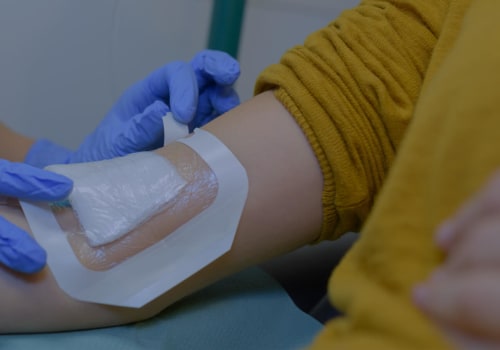 Innovative Wound Care with Enzymatic Debridement: Unlock Better Results