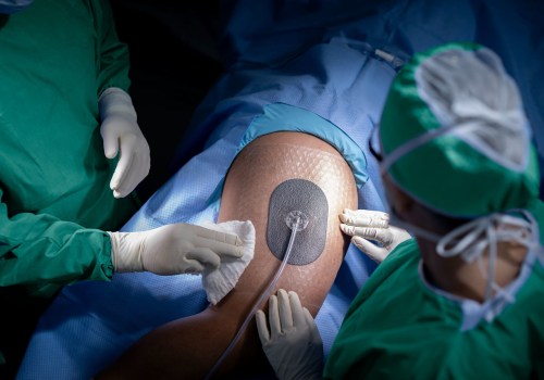 The Revolutionary Impact of Negative Pressure Therapy on Wound Healing