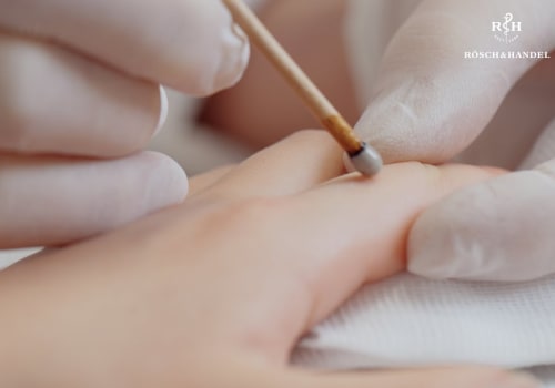 Silver Nitrate Sticks on Skin: What to Expect & How They Work